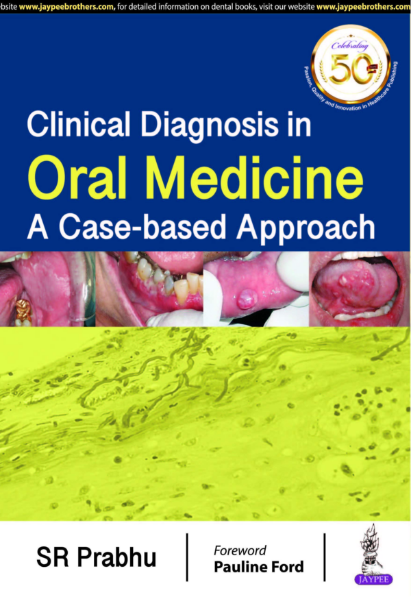 Clinical Diagnosis In Oral Medicine: A Case-Based Approach