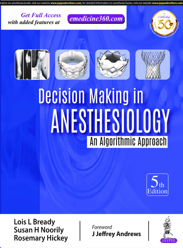 Decision Making In Anesthesiology: An Algorithmic Approach