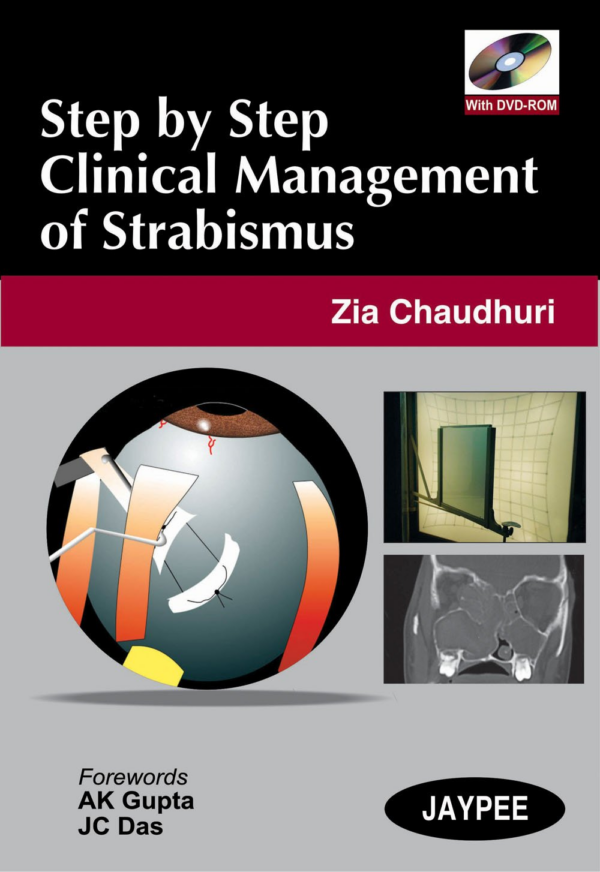 Step By Step Clinical Management Of Strabismus With Dvd-Rom