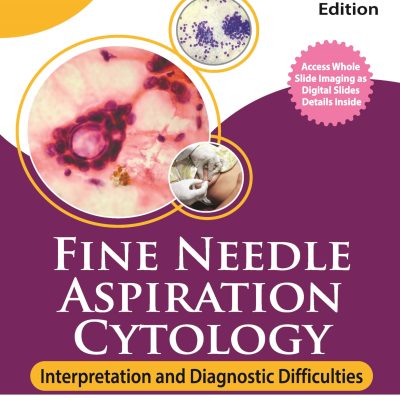Fine Needle Aspiration Cytology: Interpretation And Diagnostic Difficulties