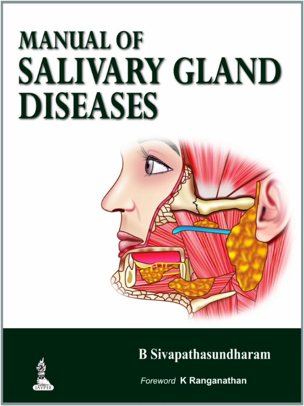 Manual Of Salivary Gland Diseases