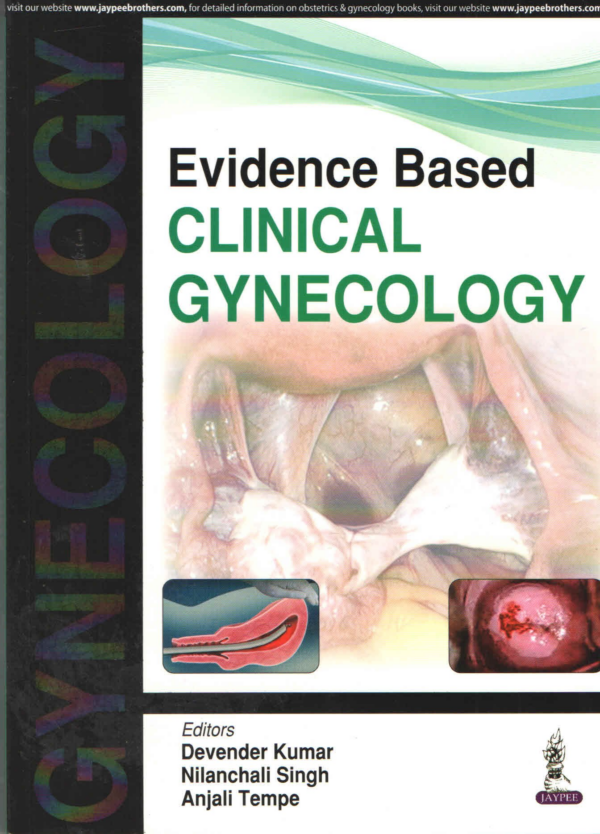 Evidence Based Clinical Gynecology
