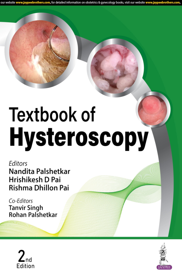 Textbook Of Hysteroscopy