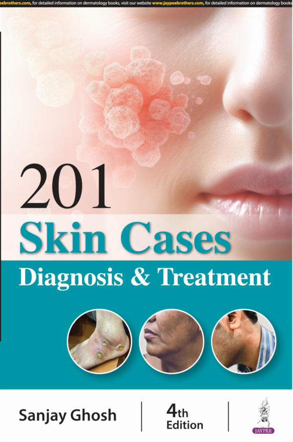 201 Skin Cases Diagnosis & Treatment
