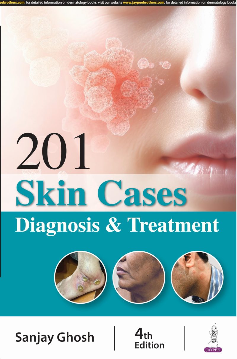 201 Skin Cases Diagnosis & Treatment
