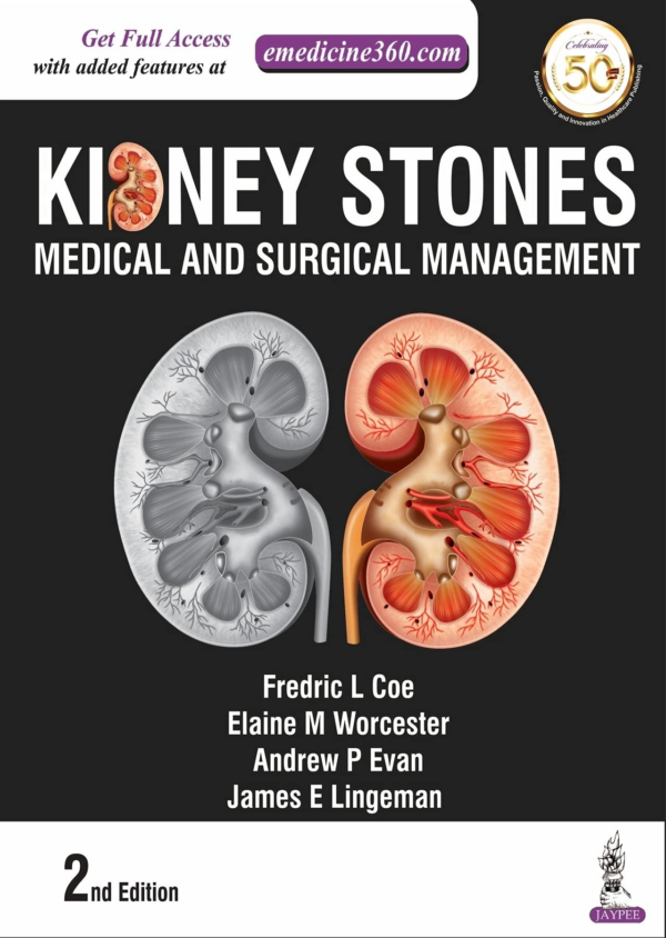 Kidney Stones: Medical And Surgical Management