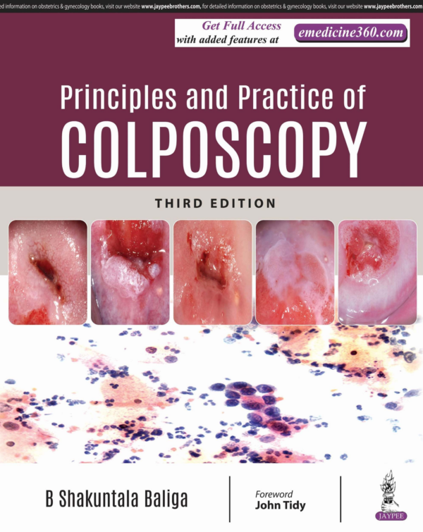Principles And Practice Of Colposcopy