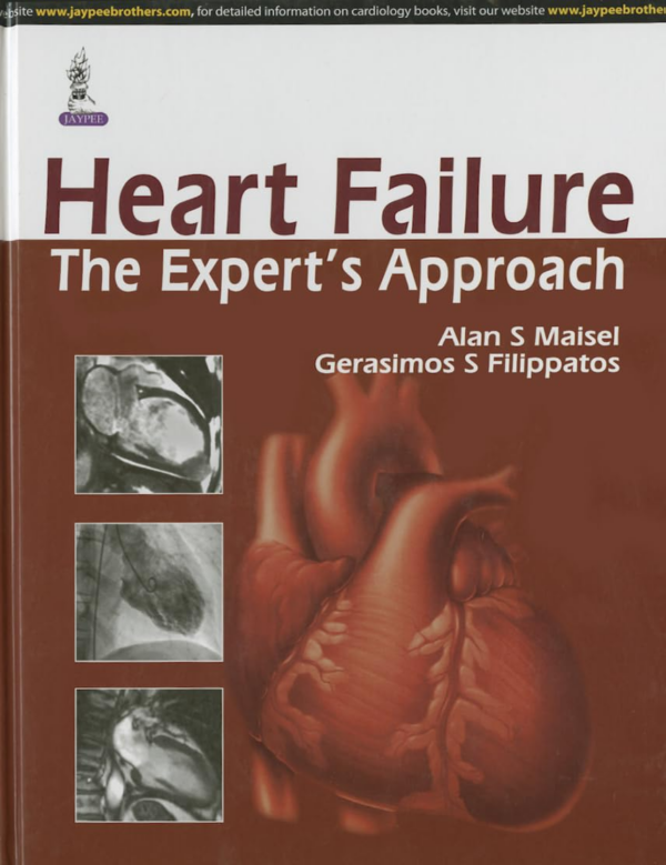 Heart Failure The Expert's Approach