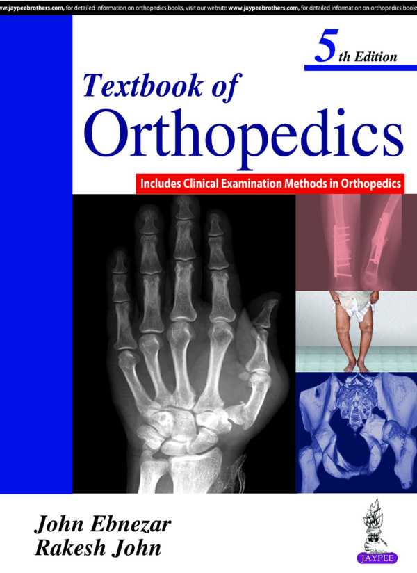 Textbook Of Orthopedics Includes Clinical Examination Methods In Orthopedics