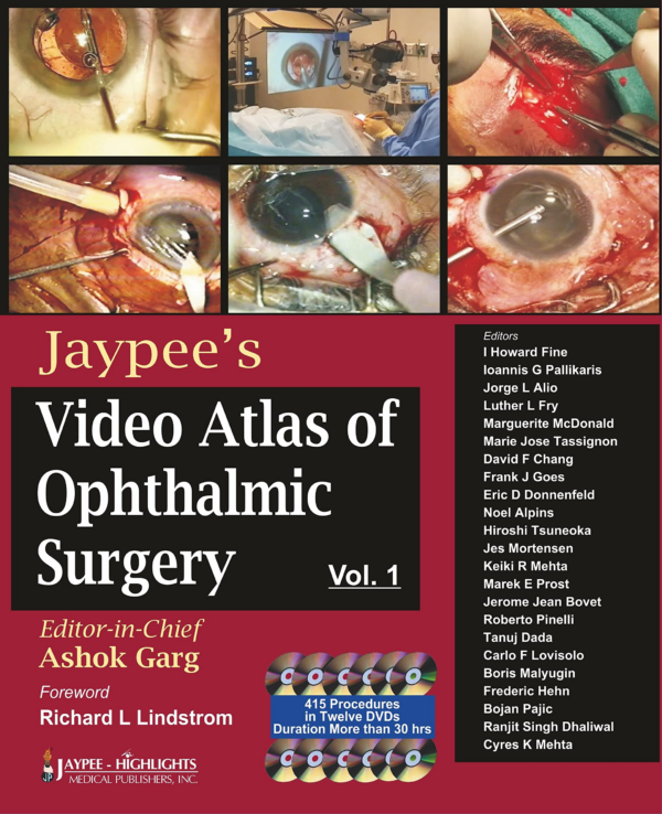 Mastery Of Holcomb C3-R Crosslinking For Keratoconus And Other Disorders:For Patients & Phy