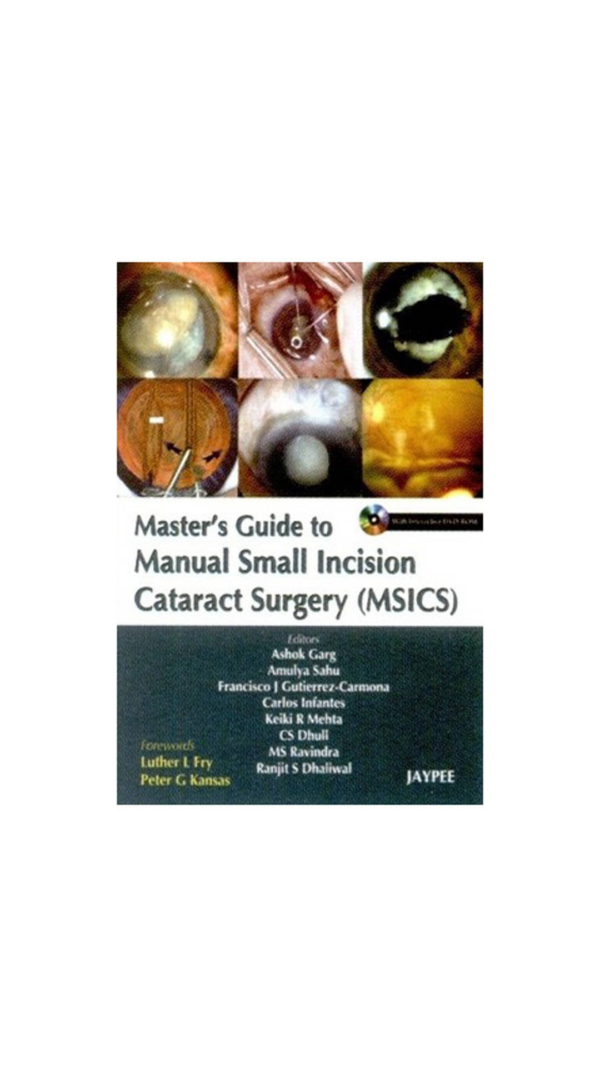 Step By Step Assisted Reproductive Technology(Art) With 2 IntDvd-Roms DrMalhotra Series