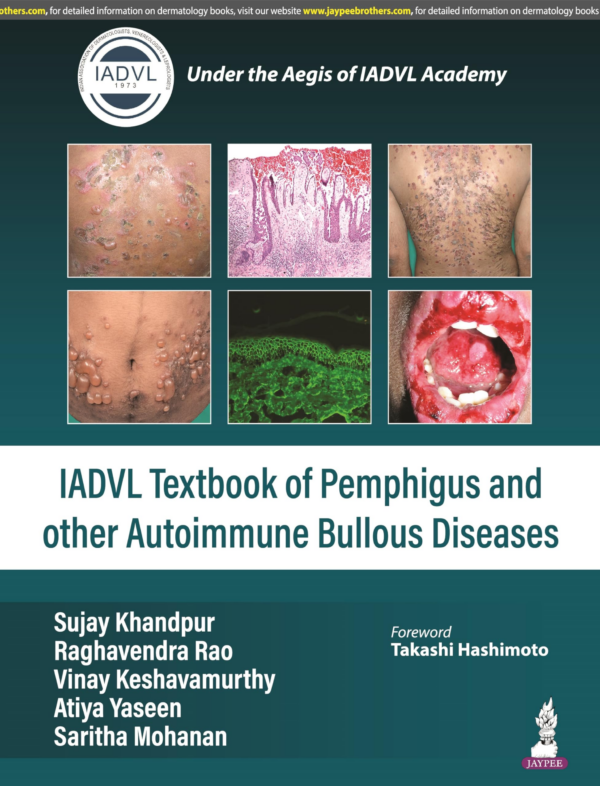 Iadvl Textbook Of Pemphigus And Other Autoimmune Bullous Diseases