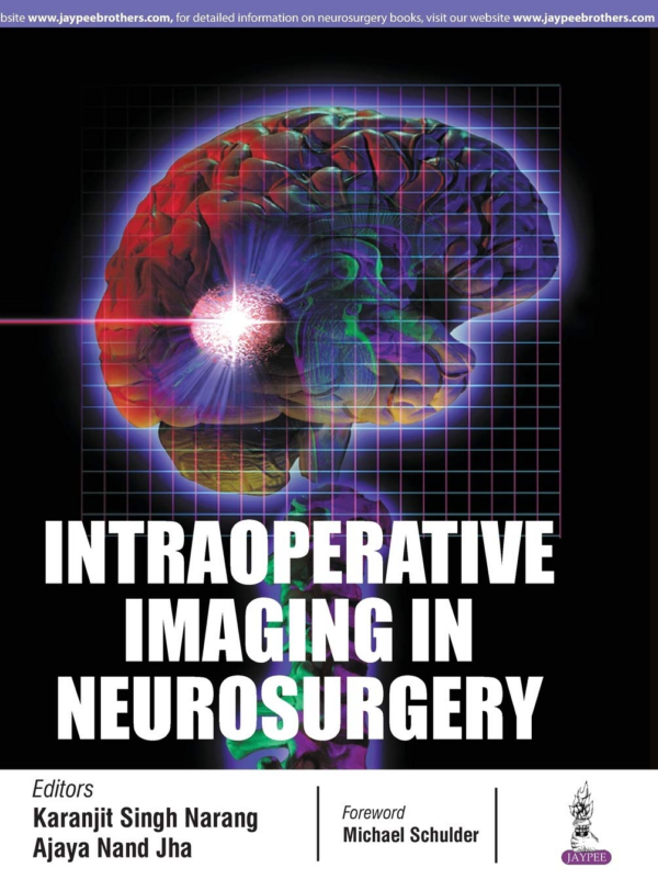 Intraoperative Imaging In Neurosurgery
