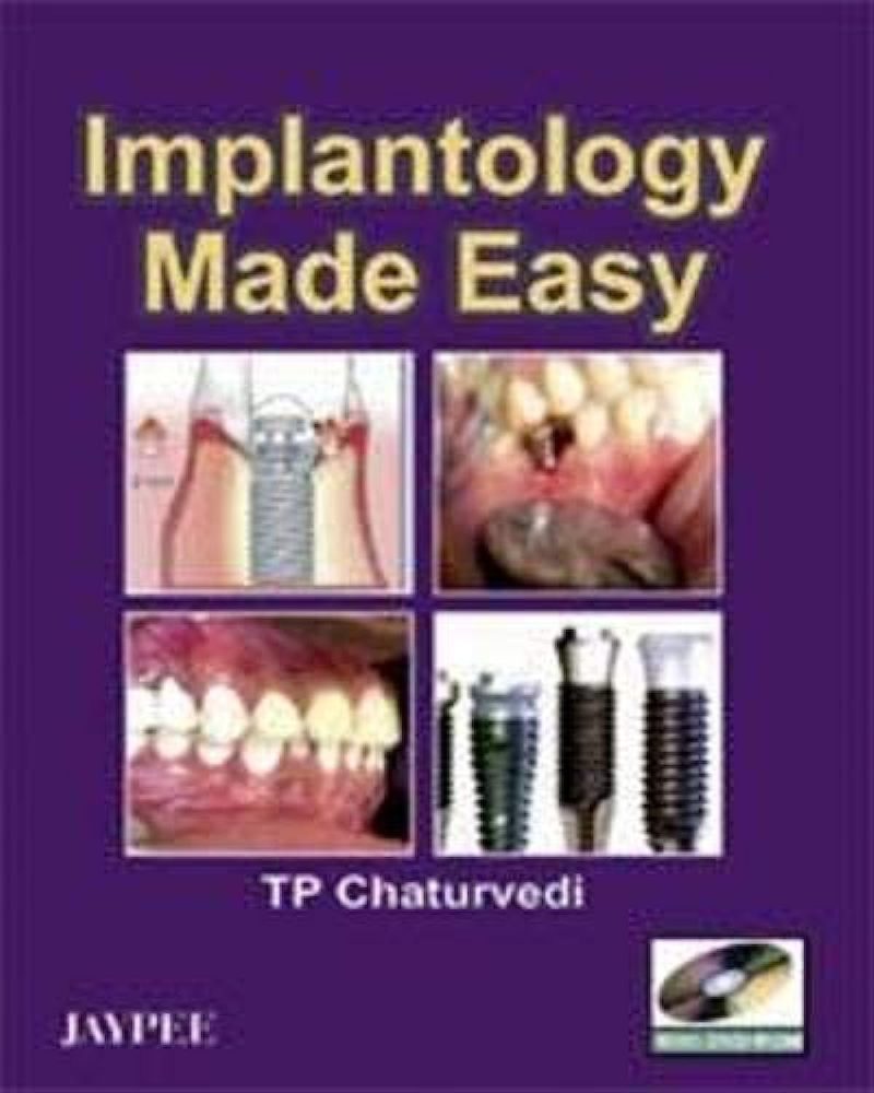 Implantology Made Easy With Dvd-Rom