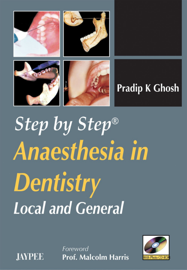 Step By Step Anaesthesia In Dentistry Local And General With Photo Cd-Rom