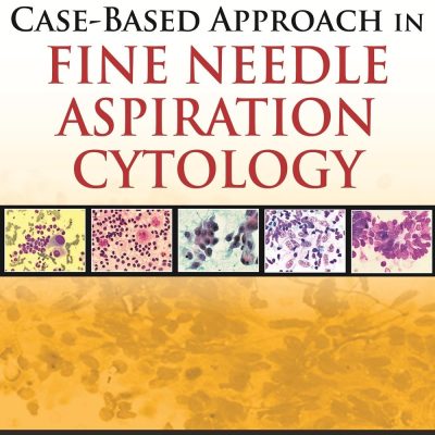 Case-Based Approach In Fine Needle Aspiration Cytology