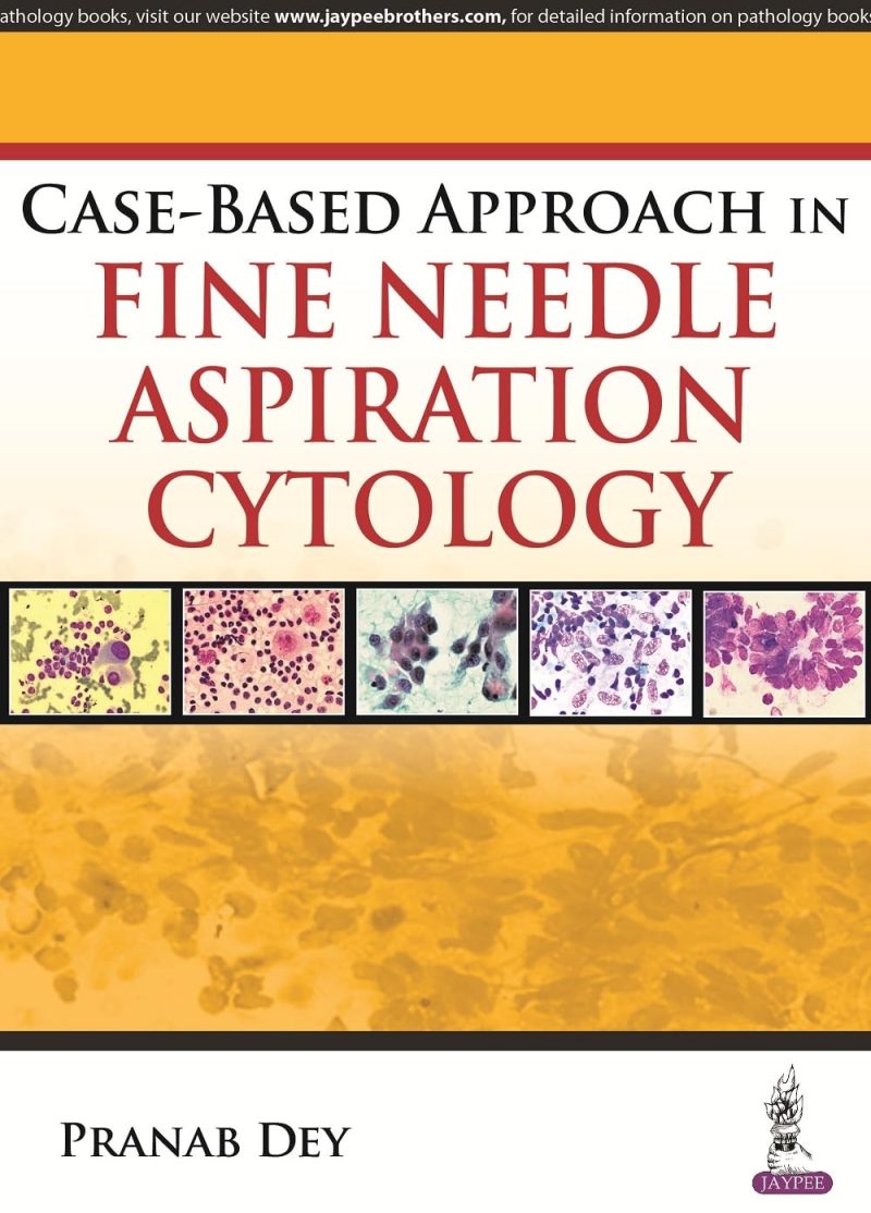 Case-Based Approach In Fine Needle Aspiration Cytology