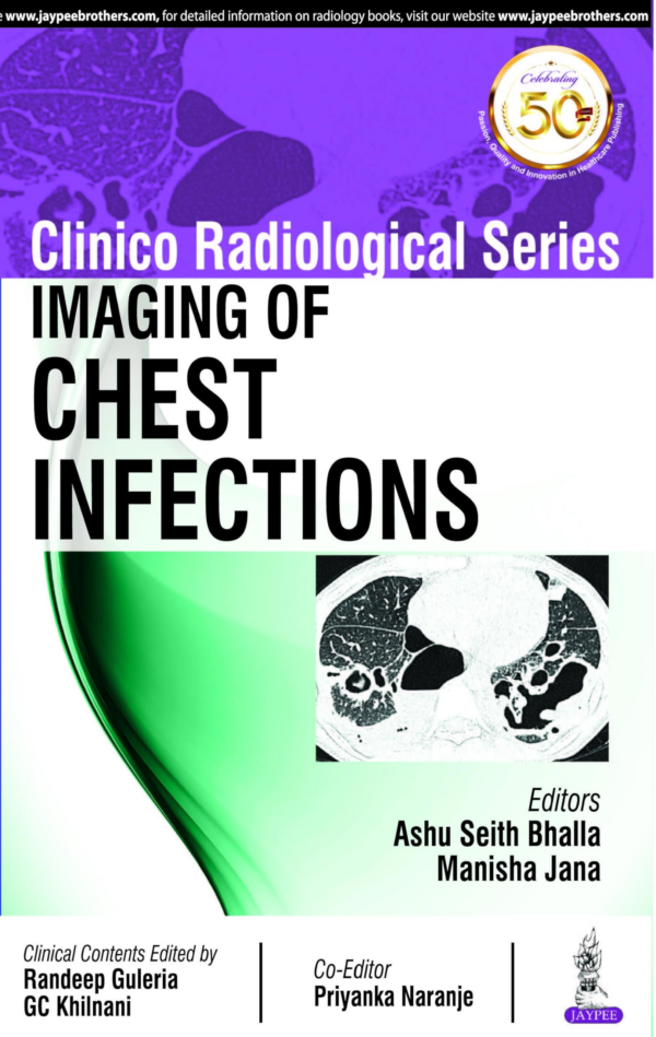 Clinico Radiological Series Imaging Of Chest Infections