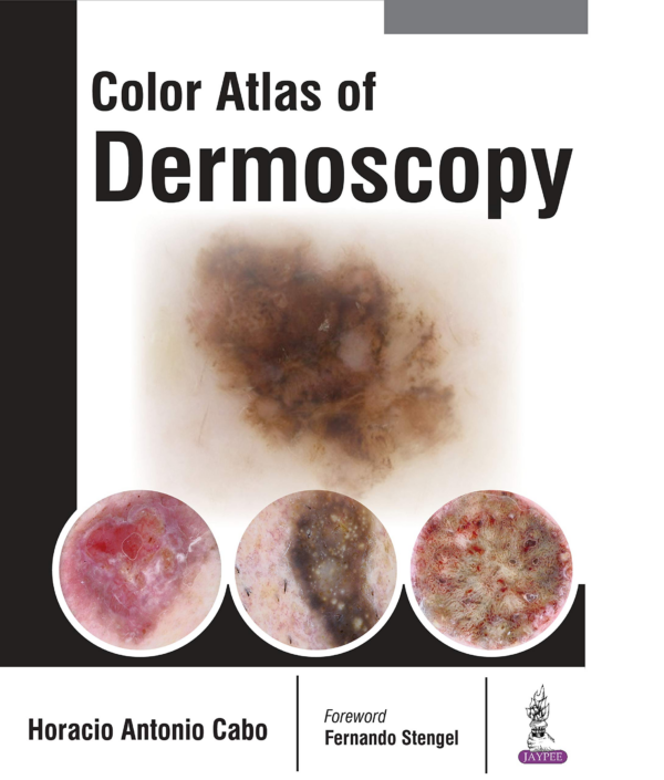 Color Atlas Of Dermoscopy