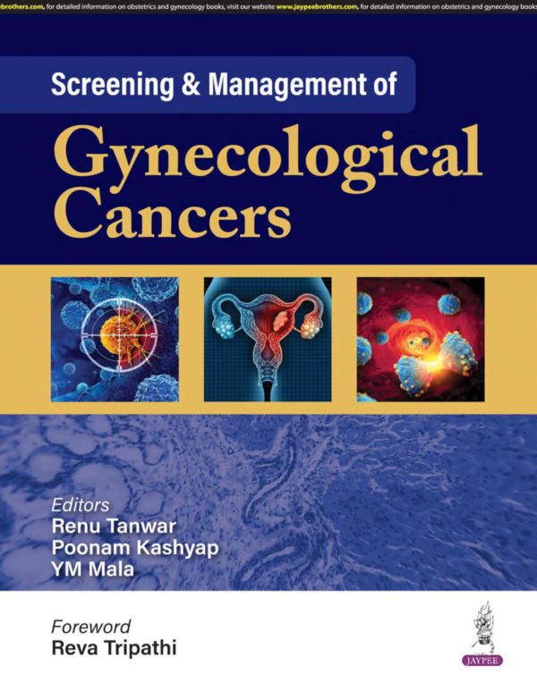 Screening & Management Of Gynecological Cancers