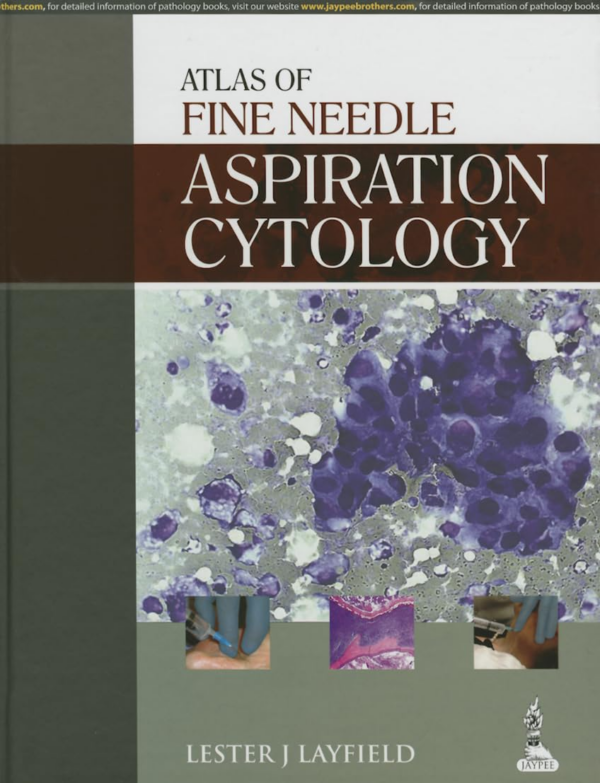 Atlas Of Fine Needle Aspiration Cytology
