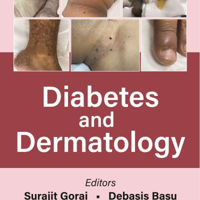Diabetes And Dermatology