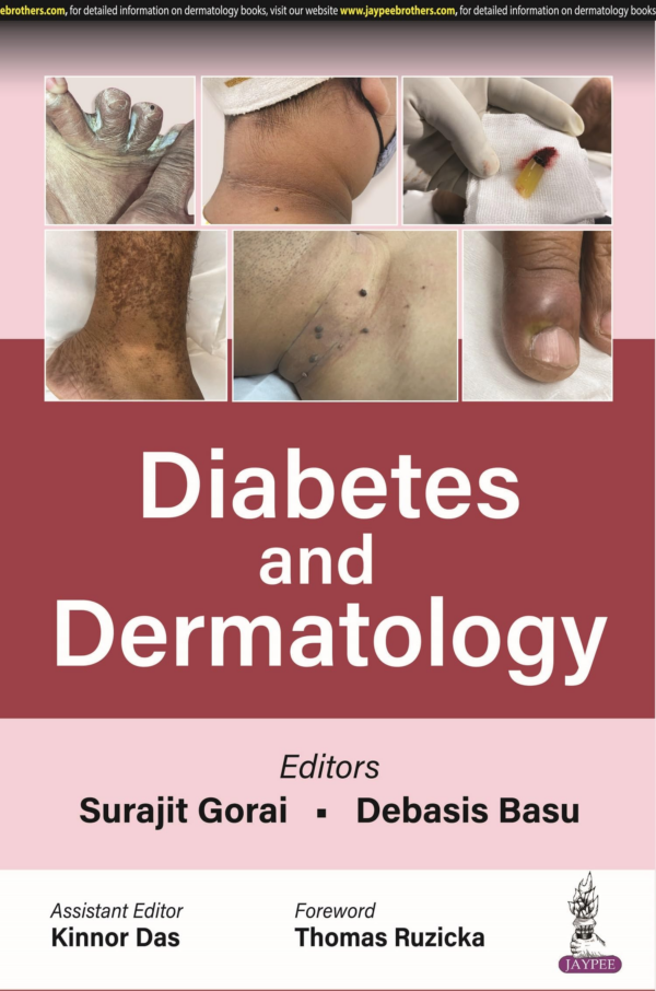 Diabetes And Dermatology