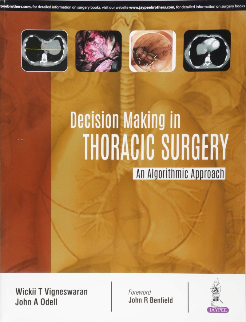 Decision Making In Thoracic Surgery An Algorithmic Approach