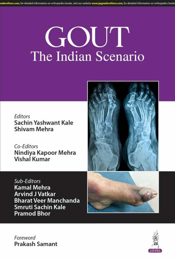 Gout The Indian Scenario