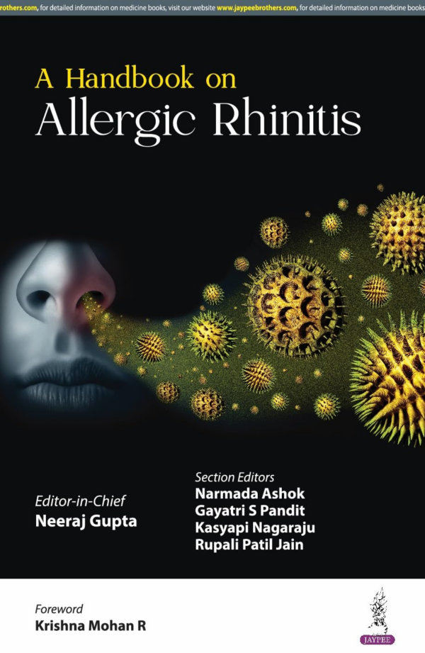 A Handbook On Allergic Rhinitis