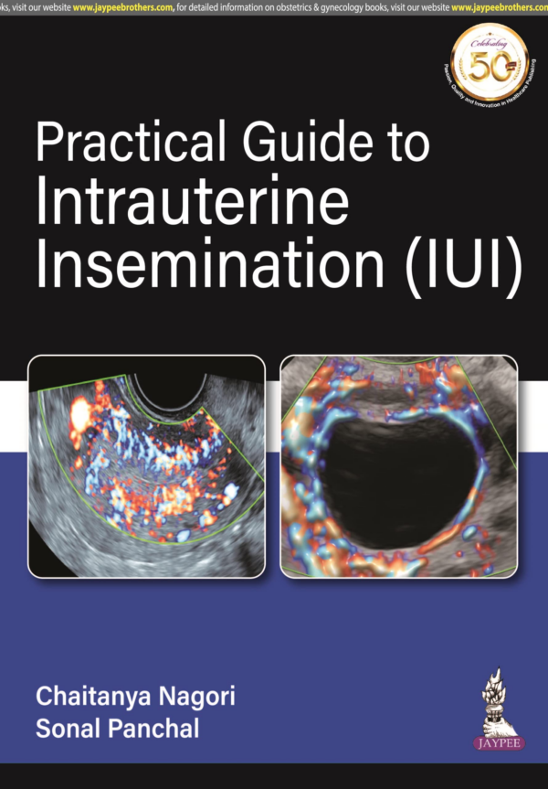 Practical Guide To Intrauterine Insemination (Iui)