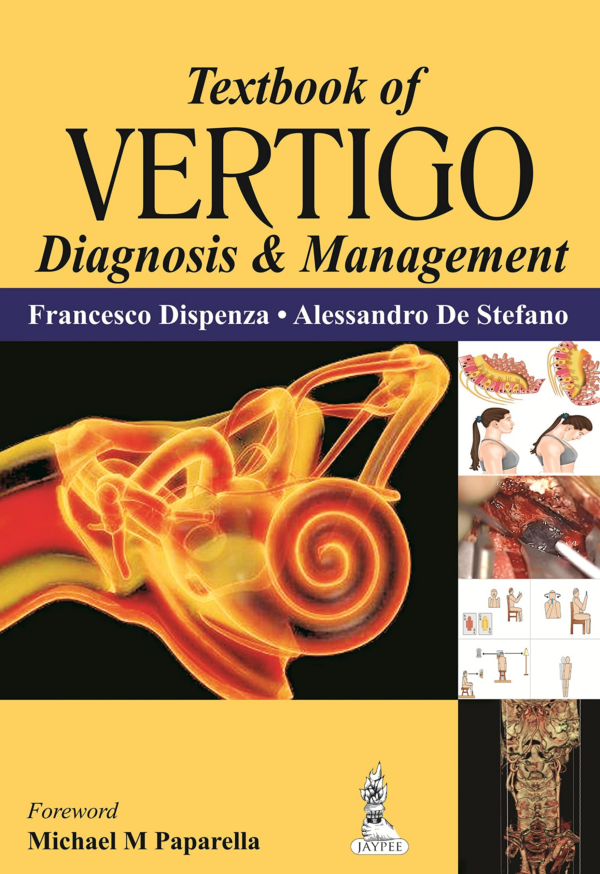 Textbook Of Vertigo Diagnosis & Management