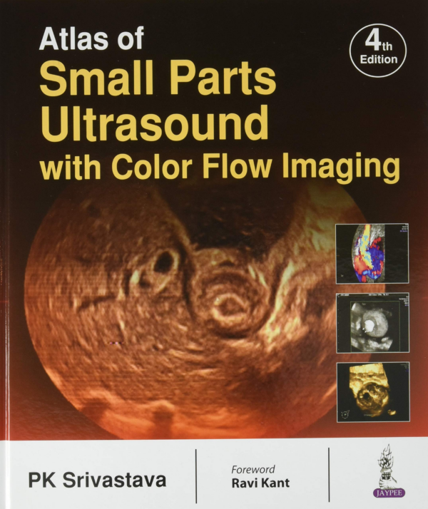 Atlas Of Small Parts Ultrasound With Color Flow Imaging