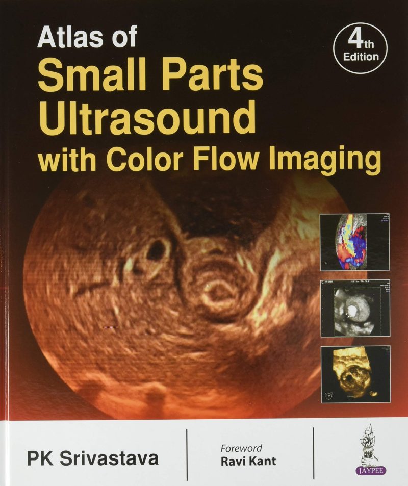 Atlas Of Small Parts Ultrasound With Color Flow Imaging