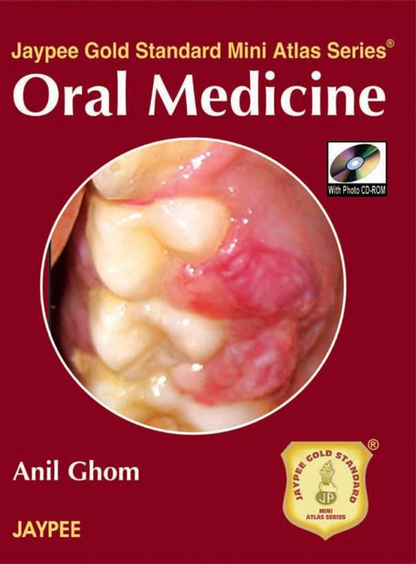Oral Medicine With Photo Cd-Rom Jaypee Gold Standard Mini Atlas Series
