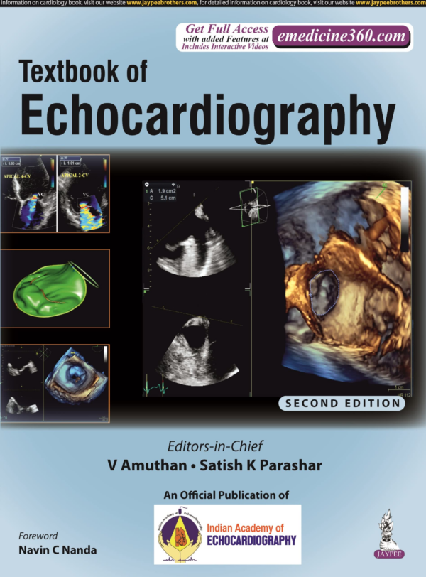 Textbook Of Echocardiography