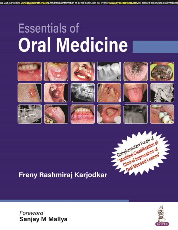Essentials Of Oral Medicine