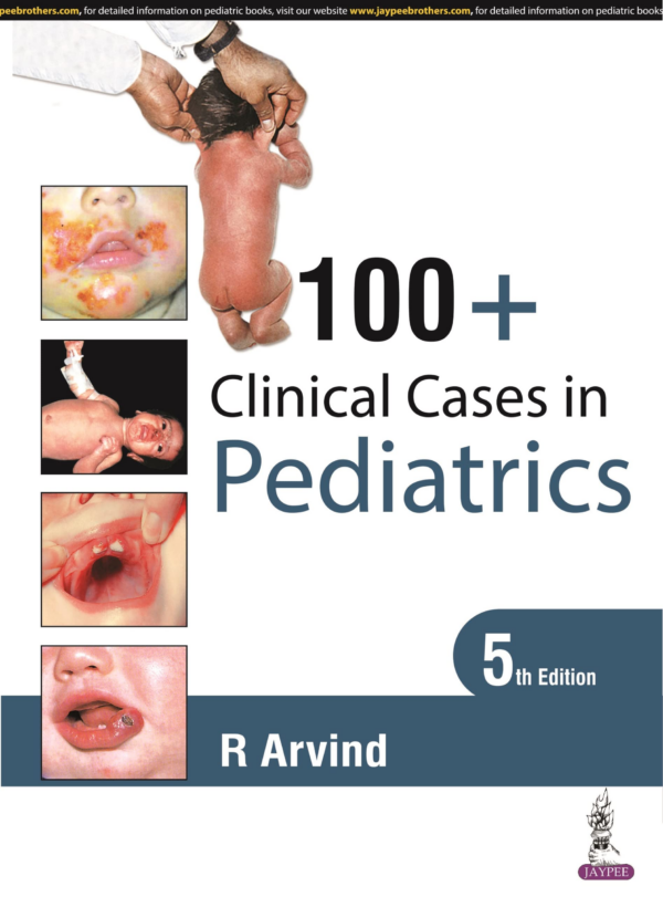 100 Clinical Cases In Pediatrics