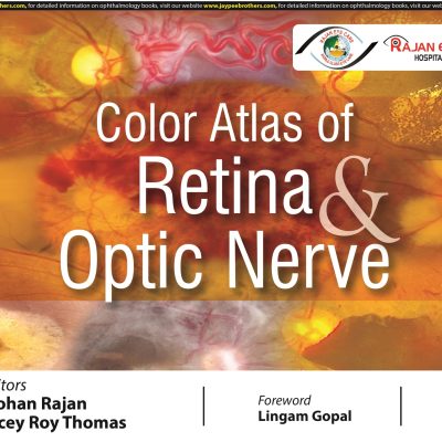 Color Atlas Of Retina & Optic Nerve