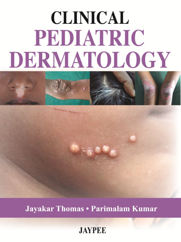 Yearbook Of Dermatology -2018 Psoriasis