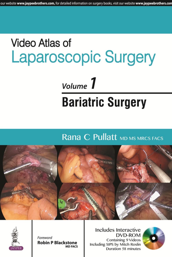 Video Atlas Of Laparoscopic Surgery Vol1 Bariatric Surgery With Dvd-Rom