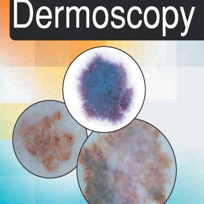 Pocket Guide To Dermoscopy