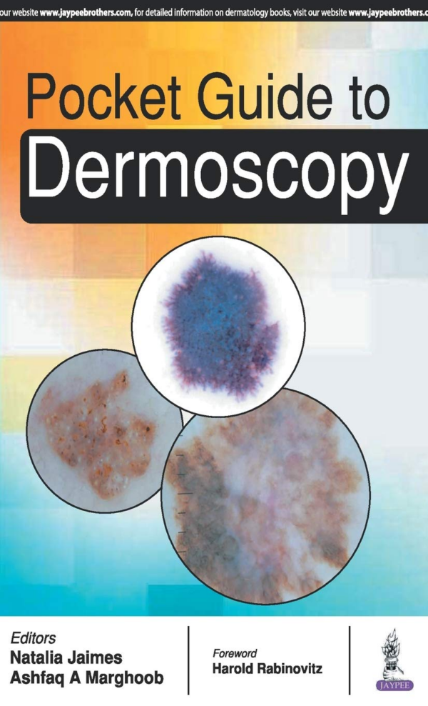 Pocket Guide To Dermoscopy