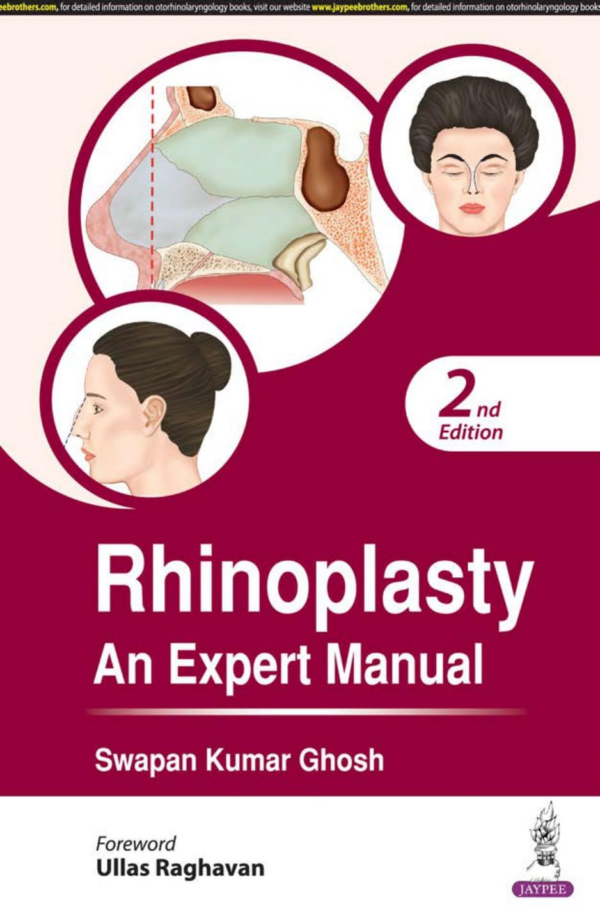 Rhinoplasty An Expert Manual