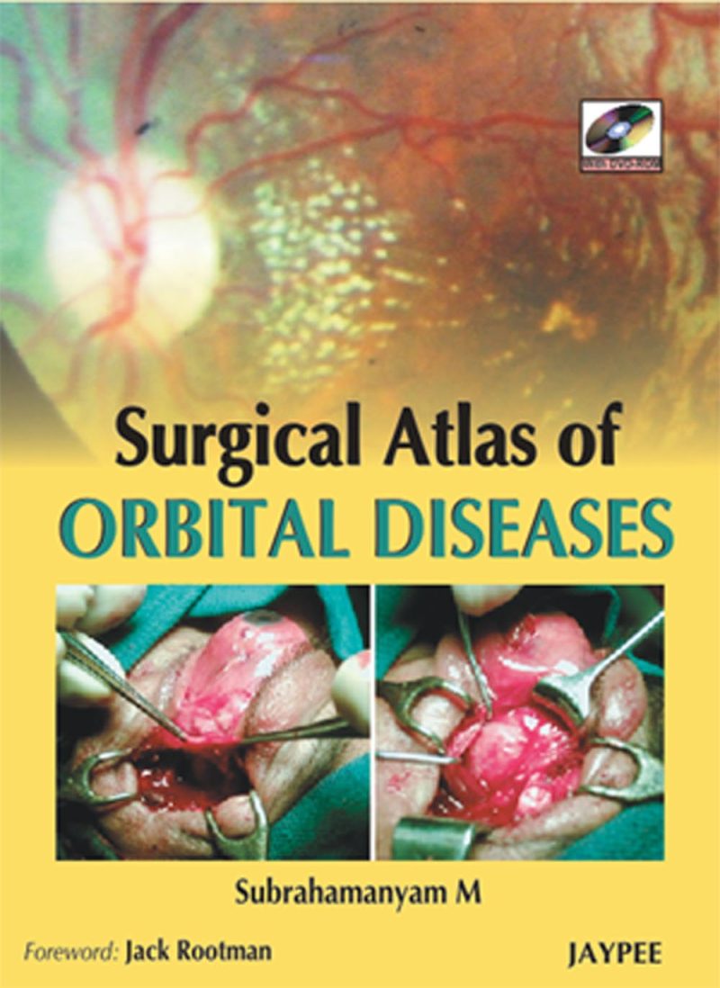 Clinico-Radiological Atlas Of Orbital Disorders