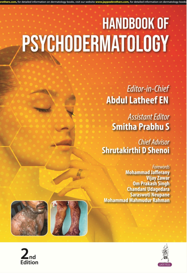 Handbook Of Psychodermatology