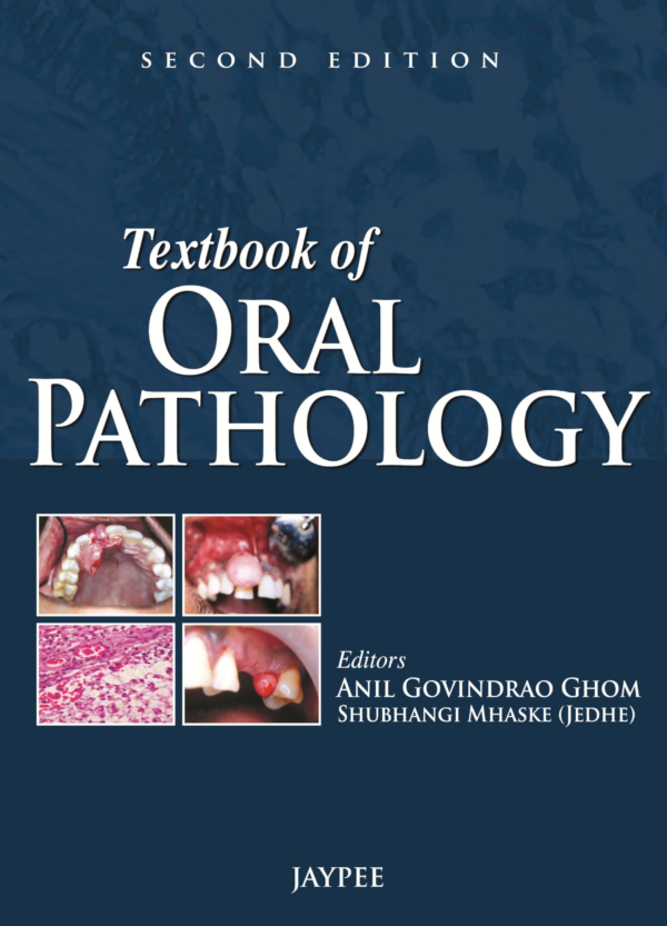 Textbook Of Oral Pathology