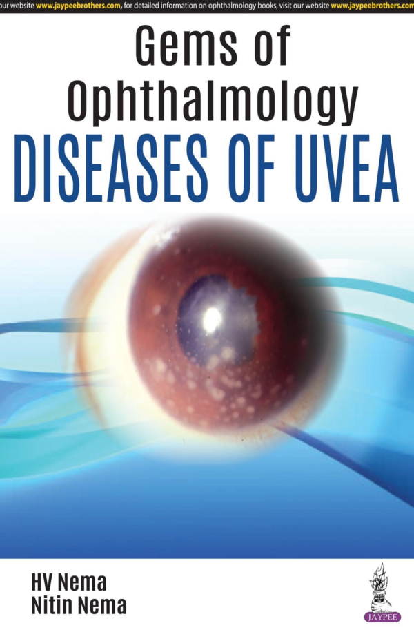 Gems Of Ophthalmology:Diseases Of Uvea