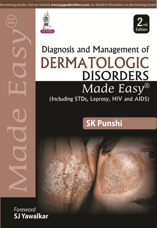 Diagnosis And Management Of Dermatologic Disorders Made Easy (Including Stds, Leprosy, Hiv And Aids)