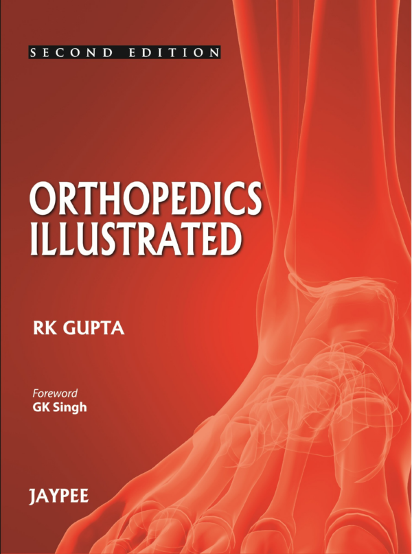 Orthopedics Illustrated